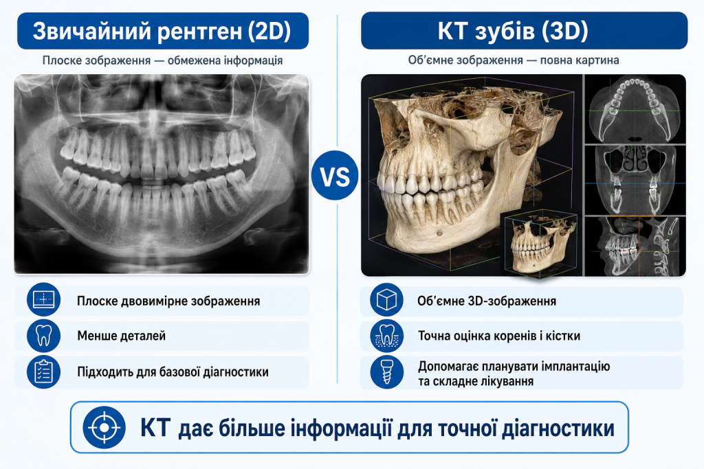 Порівняння КТ зубів і звичайного рентгену