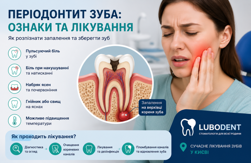 Періодонтит зуба — ознаки, симптоми та сучасне лікування запалення кореня зуба