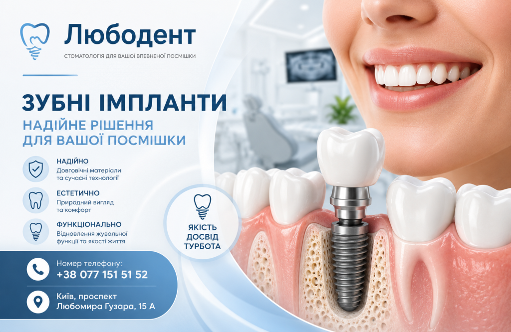 Види зубних імплантів у стоматології Любодент Київ