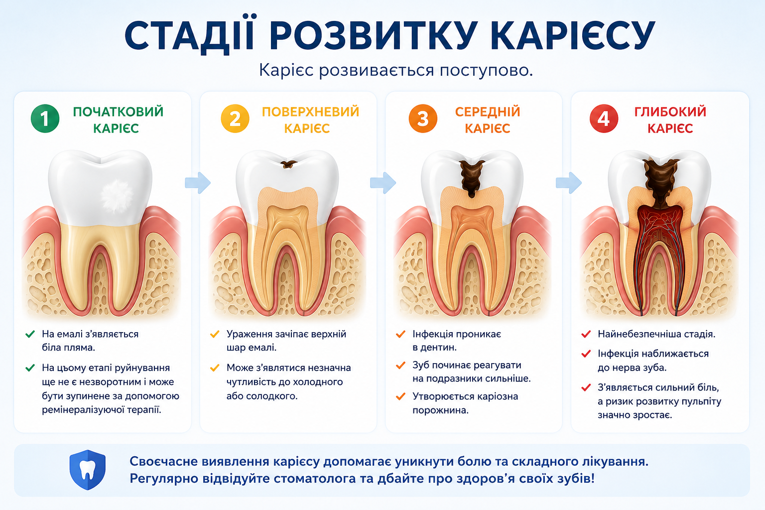 Стадії розвитку карієсу зубів